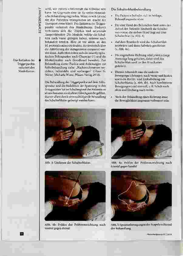 Vorschauseite 4: Das Infraspinatus-Syndrom