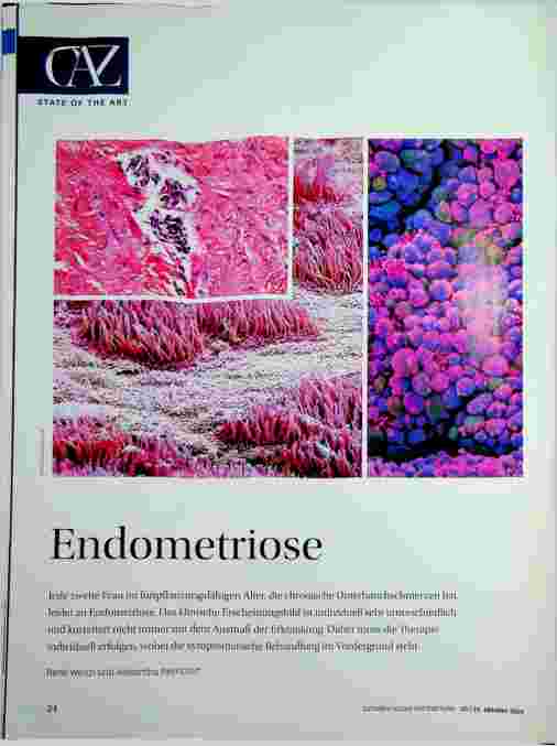 Vorschauseite 1: Endometriose