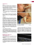 Vorschauseite 2: Nicht-invasive angiologische Diagnostik Farbkodierte Duplexsonografie (FKDS) der hirnversorgenden Gefäße