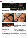 Vorschauseite 5: Nicht-invasive angiologische Diagnostik Farbkodierte Duplexsonografie (FKDS) der hirnversorgenden Gefäße