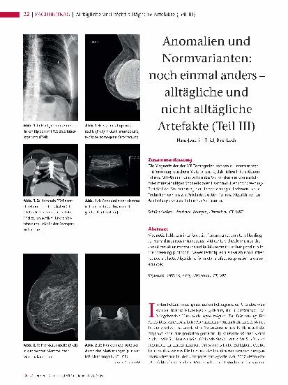 Vorschauseite 1: Anomalien und Normvarianten: noch einmal anders – alltägliche und nicht alltägliche Artefakte (Teil III)
