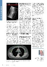 Vorschauseite 2: Künstliche Intelligenz hilft digitale Unterstützung in der Radiologie und Strahlentherapie.