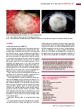 Vorschauseite 2: Schimmelpilze Teil 3: Mucor