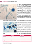 Vorschauseite 3: Schimmelpilze Teil 3: Mucor