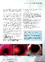 Vorschauseite 6: Refluxkrankheit