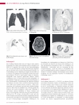 Vorschauseite 3: Long-/Post-COVID-Syndrom