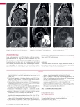Vorschauseite 5: Long-/Post-COVID-Syndrom