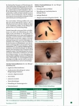 Vorschauseite 3: Blutegeltherapie - ein Segen für die Leber