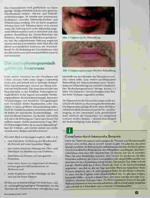 Vorschauseite 2: Colitis ulcerosa und Reizdarm Pathophysiognomik als Hinweisdiagnostik Correction: Pathophysiognomik -> Pathophysiologie