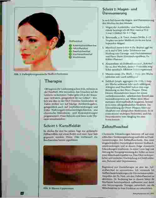 Vorschauseite 3: Colitis ulcerosa und Reizdarm Pathophysiognomik als Hinweisdiagnostik Correction: Pathophysiognomik -> Pathophysiologie