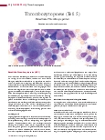 Vorschauseite 1: Thrombozytopoese (Teil 5) Hereditäre Thrombozytopenien