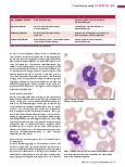 Vorschauseite 2: Thrombozytopoese (Teil 5) Hereditäre Thrombozytopenien