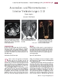 Vorschauseite 1: Anomalien und Normvarianten – Interne Veränderungen 2.13 Ureter duplex