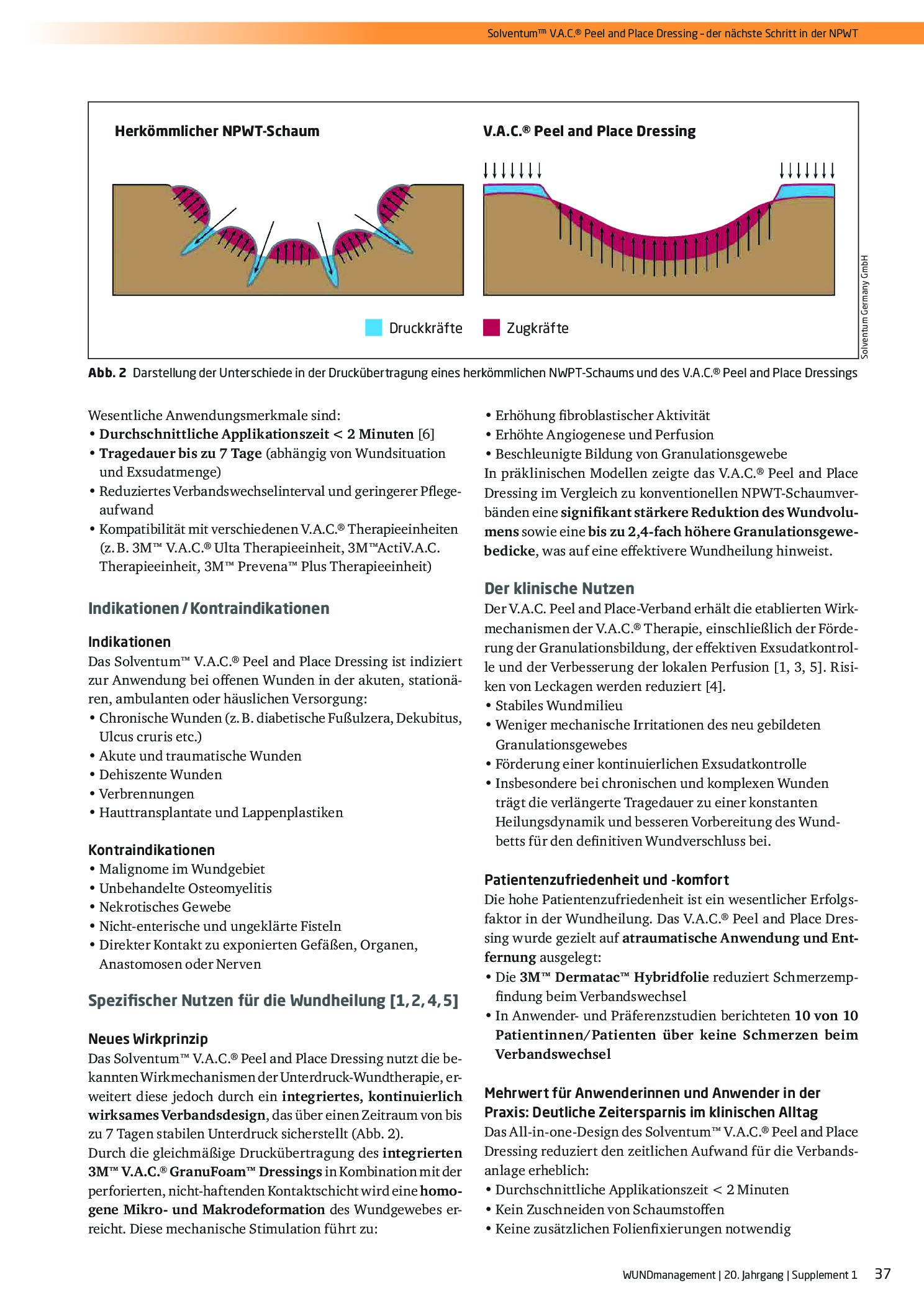 Vorschauseite 2: Solventum™ V. A. C.® Peel and Place Dressing – der nächste Schritt in der NPWT