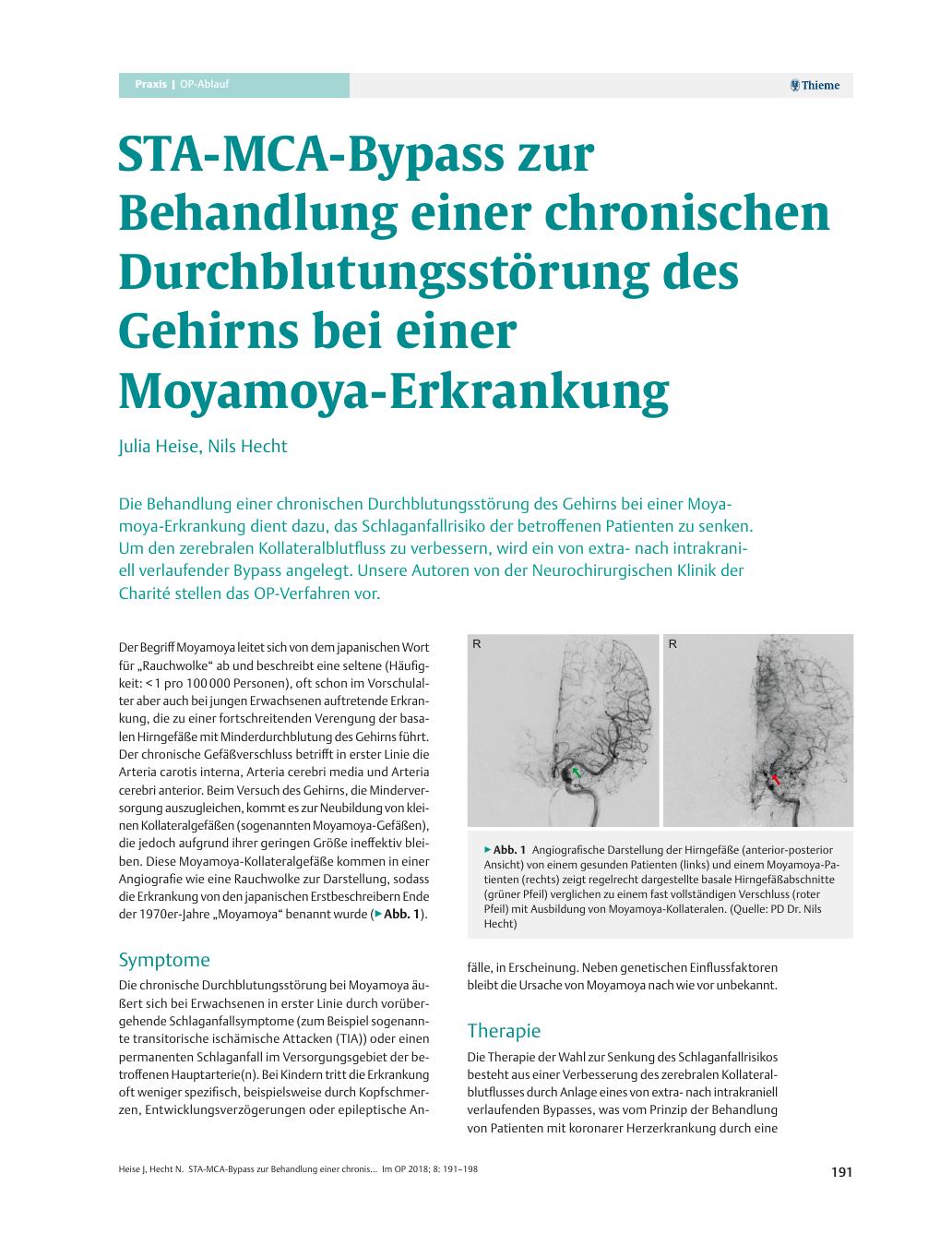 Vorschauseite 1: STA-MCA-Bypass zur Behandlung einer chronischen Durchblutungsstörung des Gehirns bei einer Moyamoya-Erkrankung