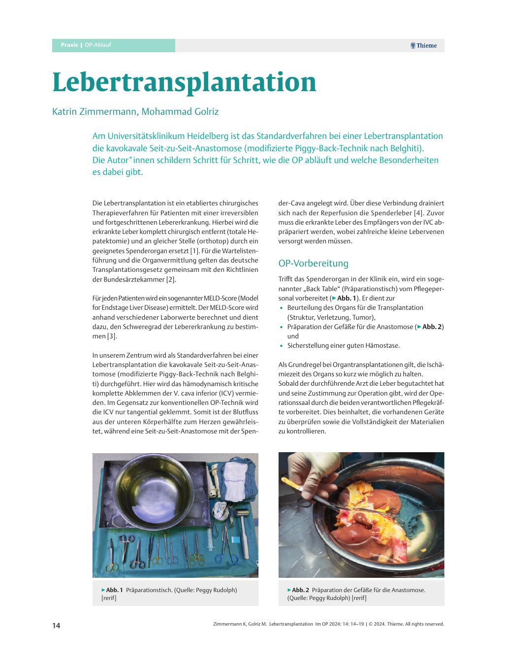Vorschauseite 1: Lebertransplantation