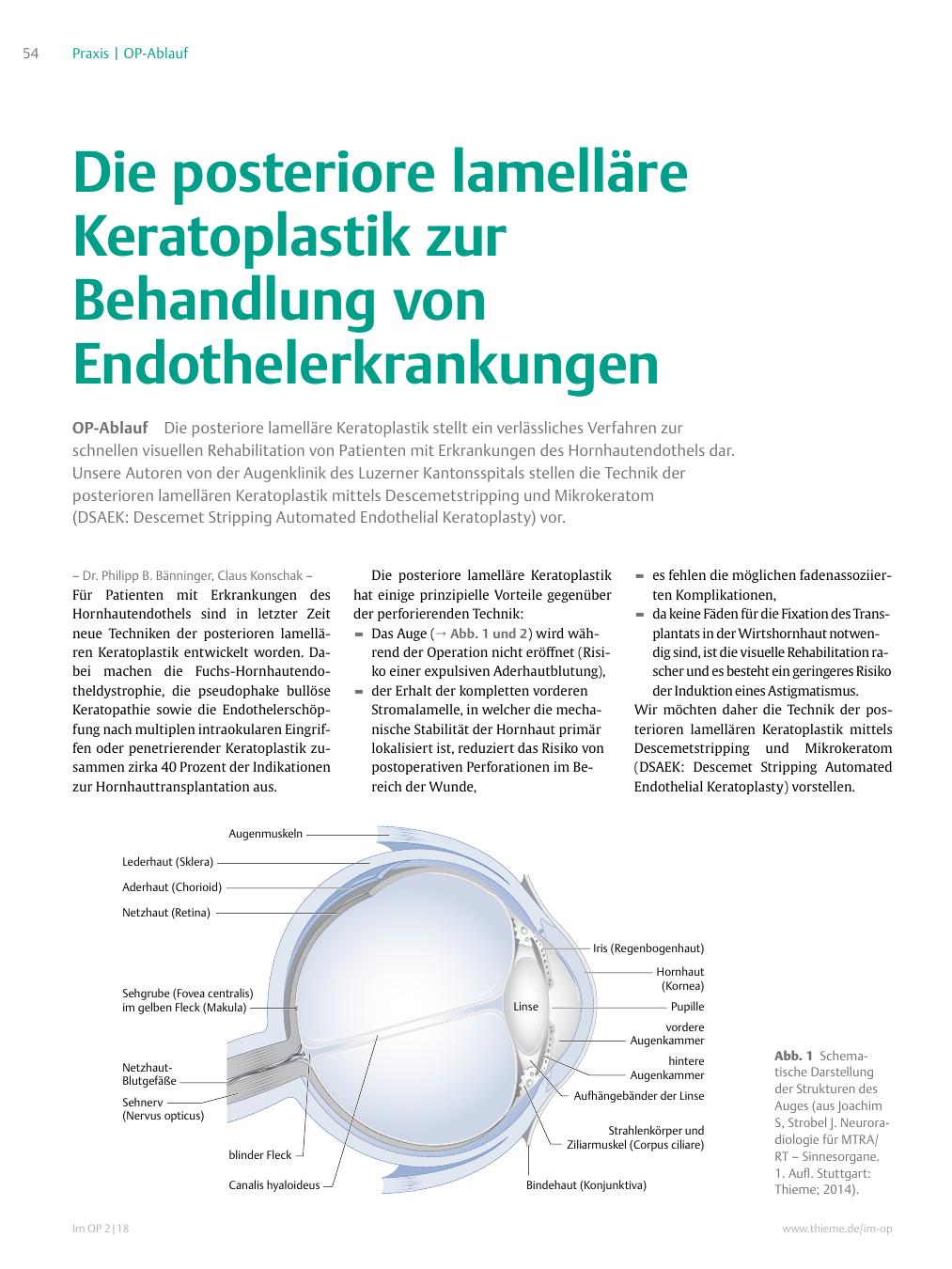Vorschauseite 1: Die posteriore lamelläre Keratoplastik zur Behandlung von Endothelerkrankungen