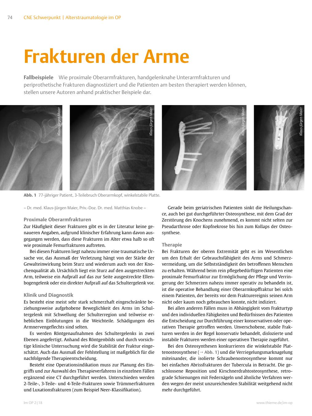 Vorschauseite 1: Frakturen der Arme