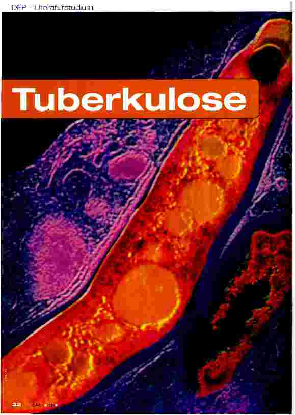 Vorschauseite 1: Tuberkulose