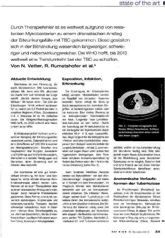 Vorschauseite 2: Tuberkulose