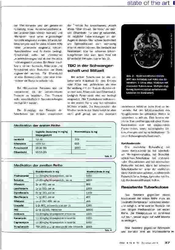 Vorschauseite 5: Tuberkulose