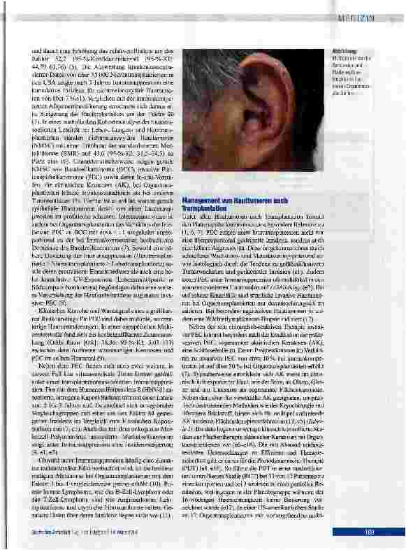Vorschauseite 2: Hautveränderungen nach Organtransplantation