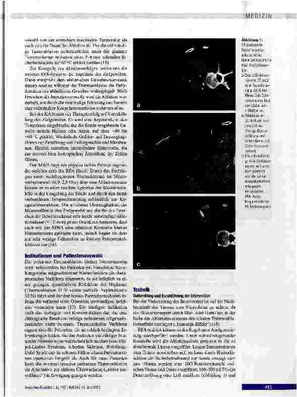 Vorschauseite 2: Thermoablation von Nierentumoren: Indikationen, Techniken und Ergebnisse