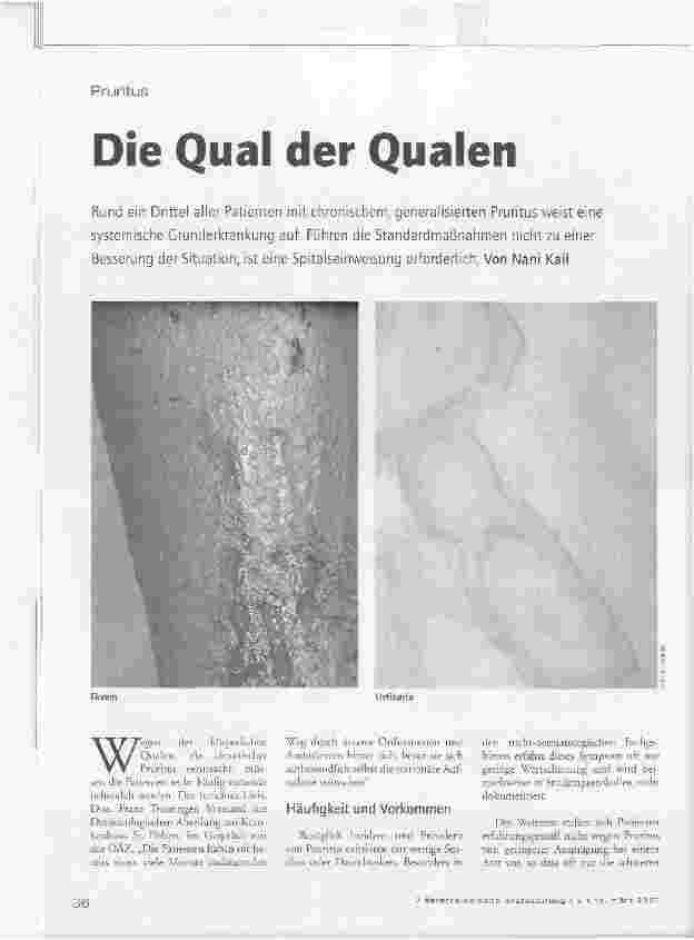 Vorschauseite 1: Die Qual der Qualen