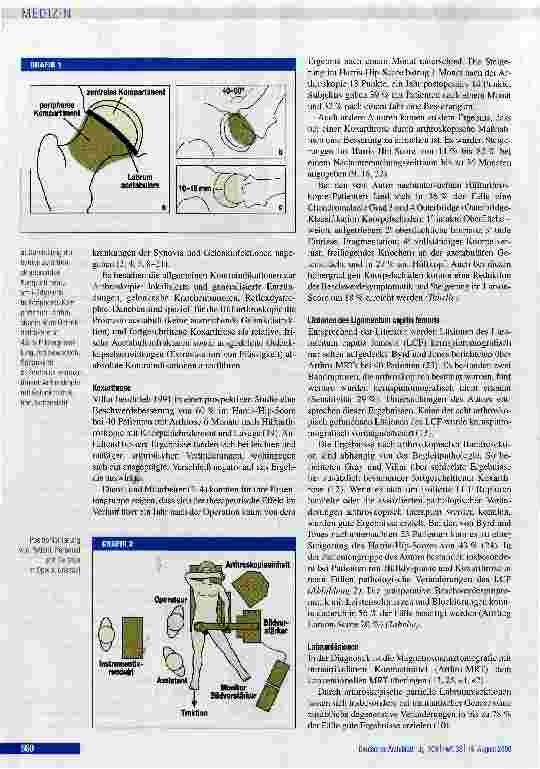 Vorschauseite 2: Arthroskopie des HüftgelenksIndikation, Technik, Ergebnisse