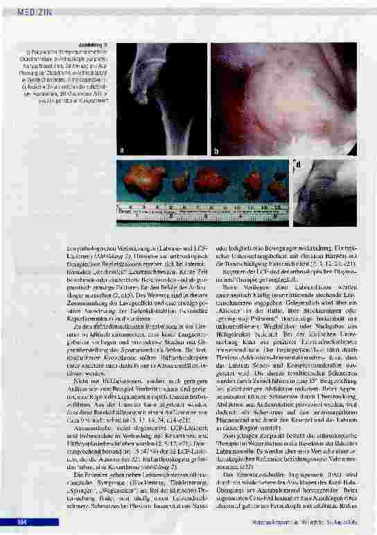 Vorschauseite 6: Arthroskopie des HüftgelenksIndikation, Technik, Ergebnisse