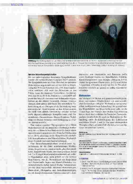 Vorschauseite 4: Hyperhidrose - Ursachen und Therapie von übermäßigem Schwitzen