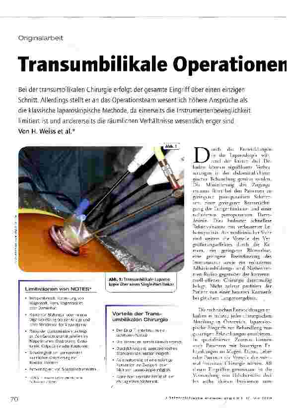 Vorschauseite 1: Transumbilikale Operationen ohne sichtbare Narben