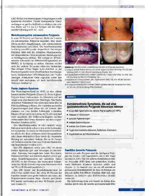 Vorschauseite 5: Differenzialdiagnostik und Früherkennung hereditärer gastrointestinaler Polyposis-Syndrome