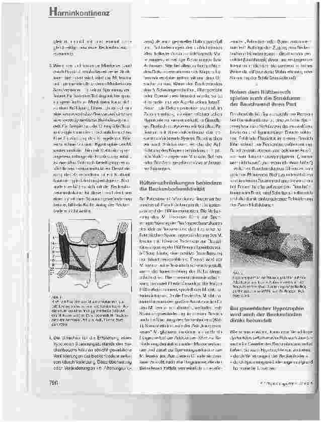 Vorschauseite 3: Therapie der Harninkontinenz oder Beckenbodenübungen?