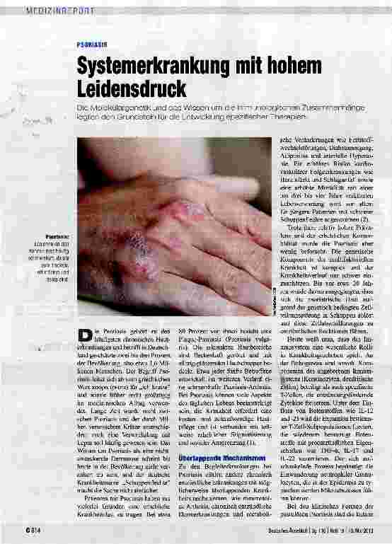 Vorschauseite 1: Systemerkrankung mit hohem Leidensdruck
