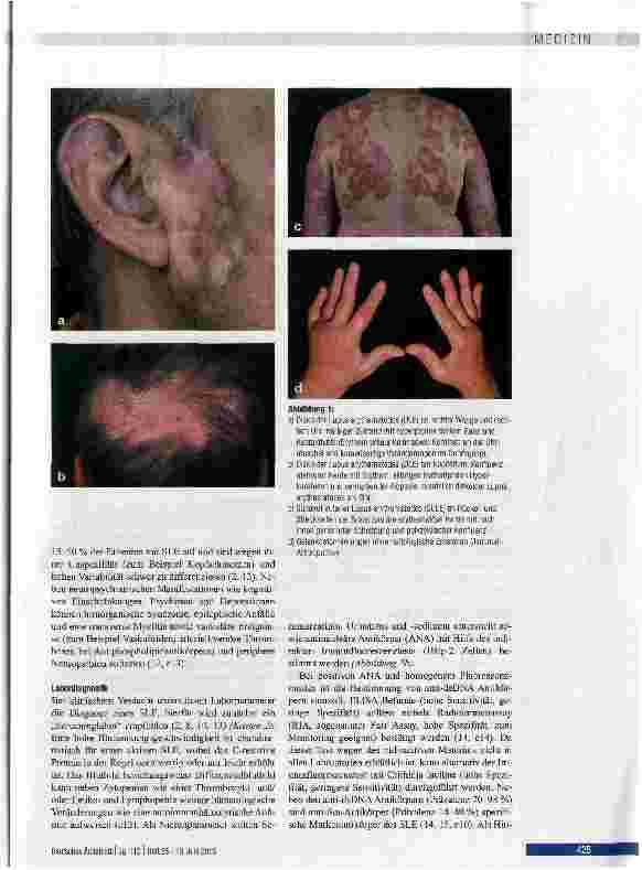 Vorschauseite 3: Diagnostik und Therapie des systemischen Lupus erythematodes