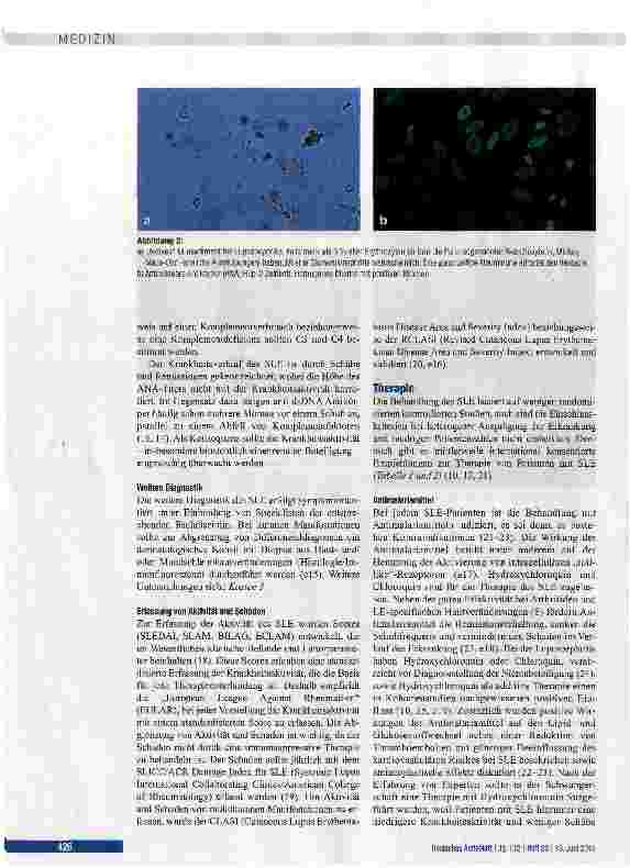 Vorschauseite 4: Diagnostik und Therapie des systemischen Lupus erythematodes