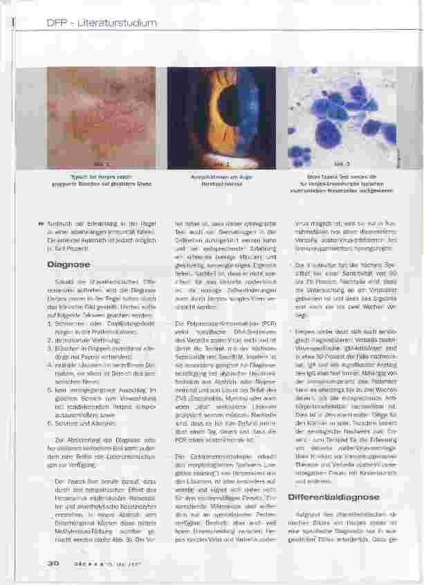 Vorschauseite 4: Herpes zoster