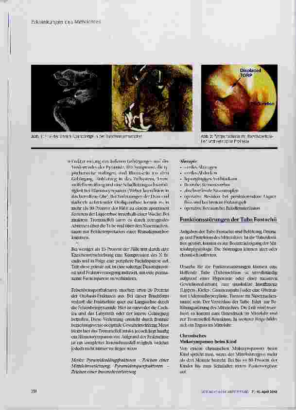 Vorschauseite 3: Erkrankungen des Mittelohres