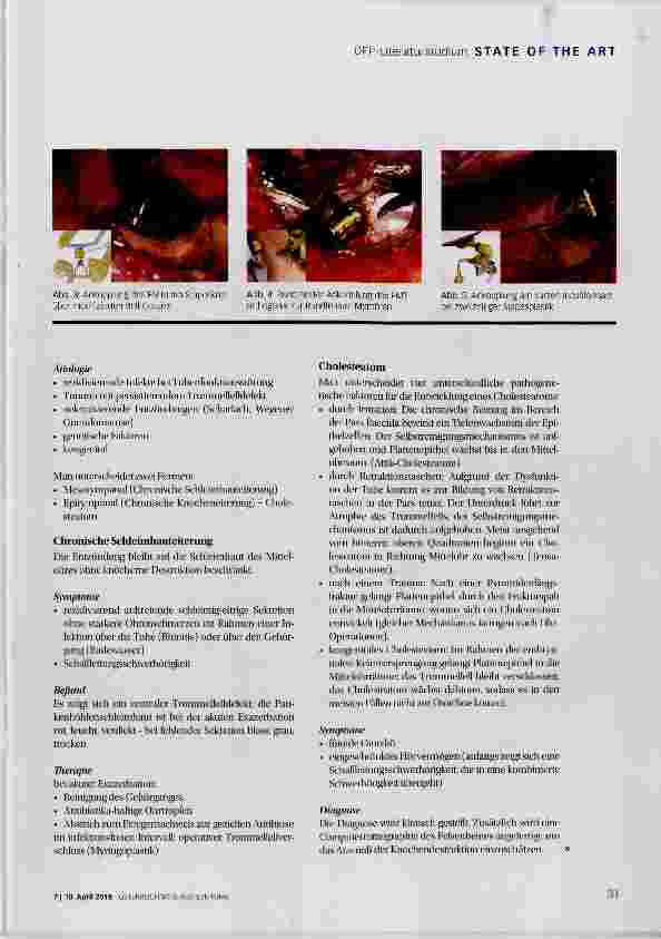 Vorschauseite 6: Erkrankungen des Mittelohres