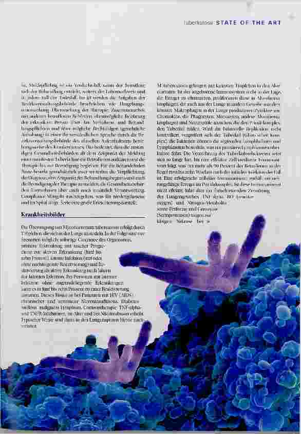 Vorschauseite 2: Tuberkulose