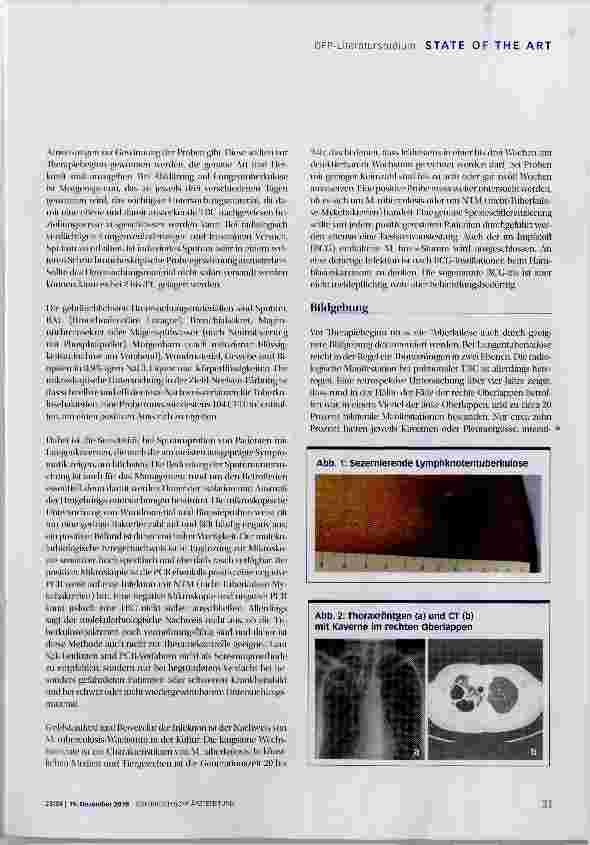Vorschauseite 4: Tuberkulose