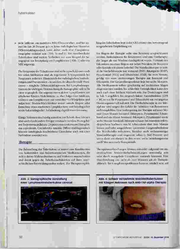 Vorschauseite 5: Tuberkulose