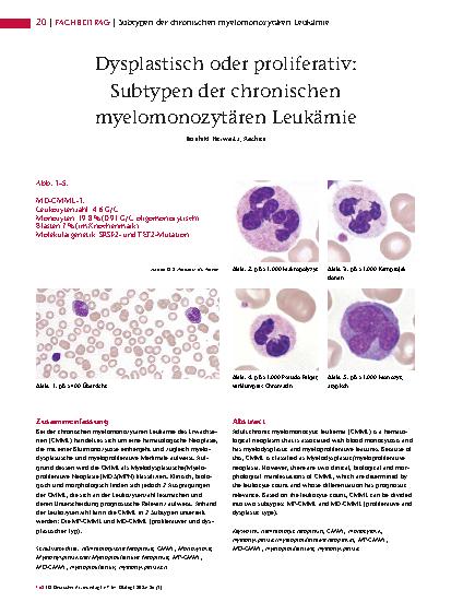 Vorschauseite 1: Dysplastisch oder proliferativ: Subtypen der chronischen myelomonozytären Leukämie