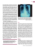 Vorschauseite 2: Pneumocystis - ein eigenartiger Pilz!