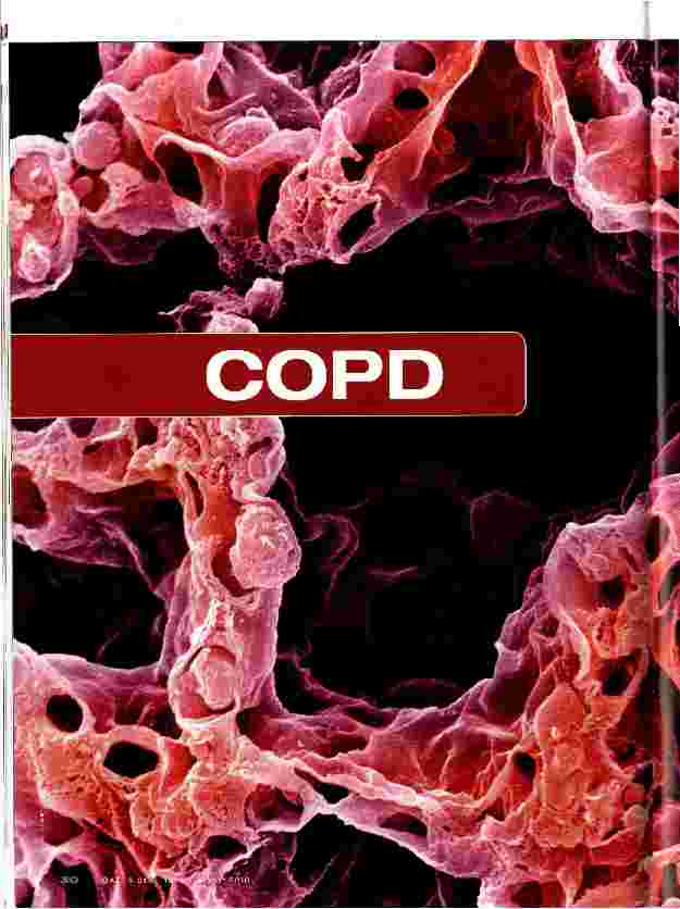 Vorschauseite 1: COPD