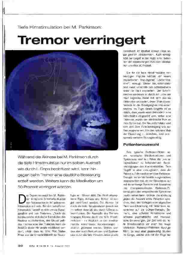 Vorschauseite 1: Tremor verringert