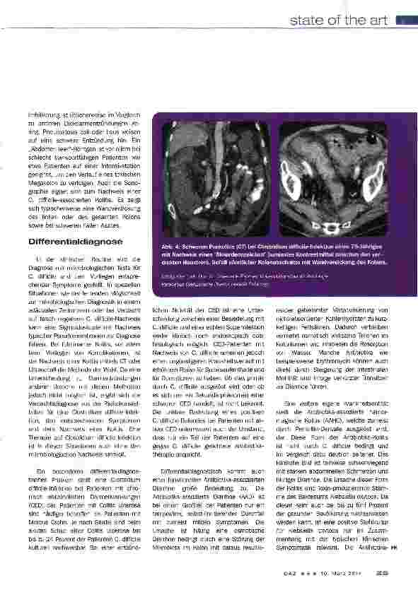 Vorschauseite 5: Clostridium difficile Infektion