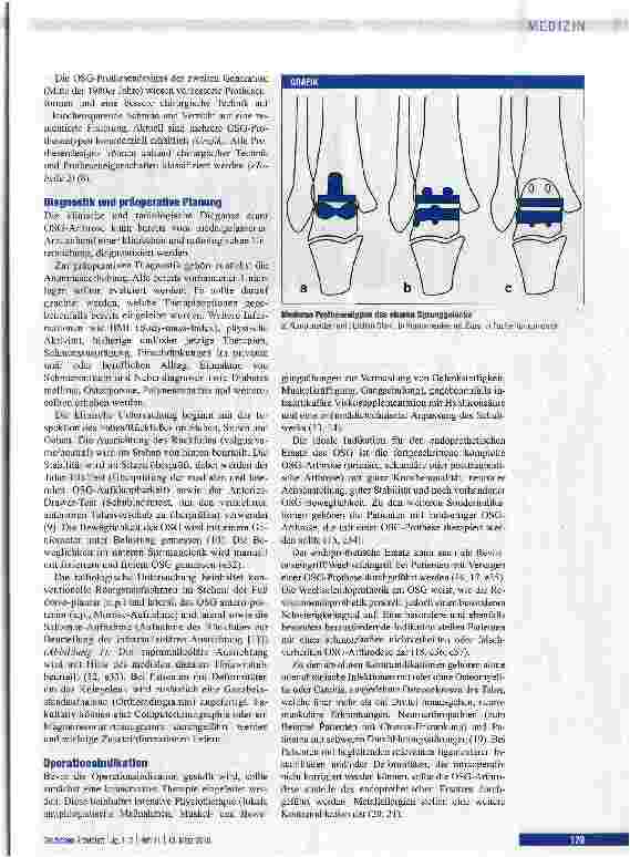 Vorschauseite 3: Endoprothetischer Ersatz des oberen Sprunggelenks