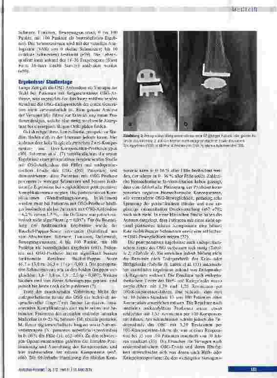 Vorschauseite 5: Endoprothetischer Ersatz des oberen Sprunggelenks